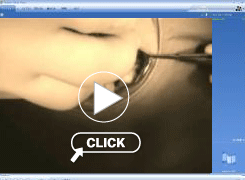 1本の下顎インプラント埋入手術ムービー